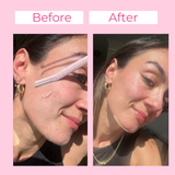 PeachRaze - Eco-Friendly Dermaplaning Razor ( 9 Razors -Glow Bundle)