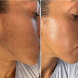 PeachRaze - Eco-Friendly Dermaplaning Razor (6 Razors-BFF Bundle)