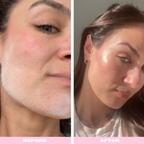 PeachRaze - Eco-Friendly Dermaplaning Razor (6 Razors-BFF Bundle)